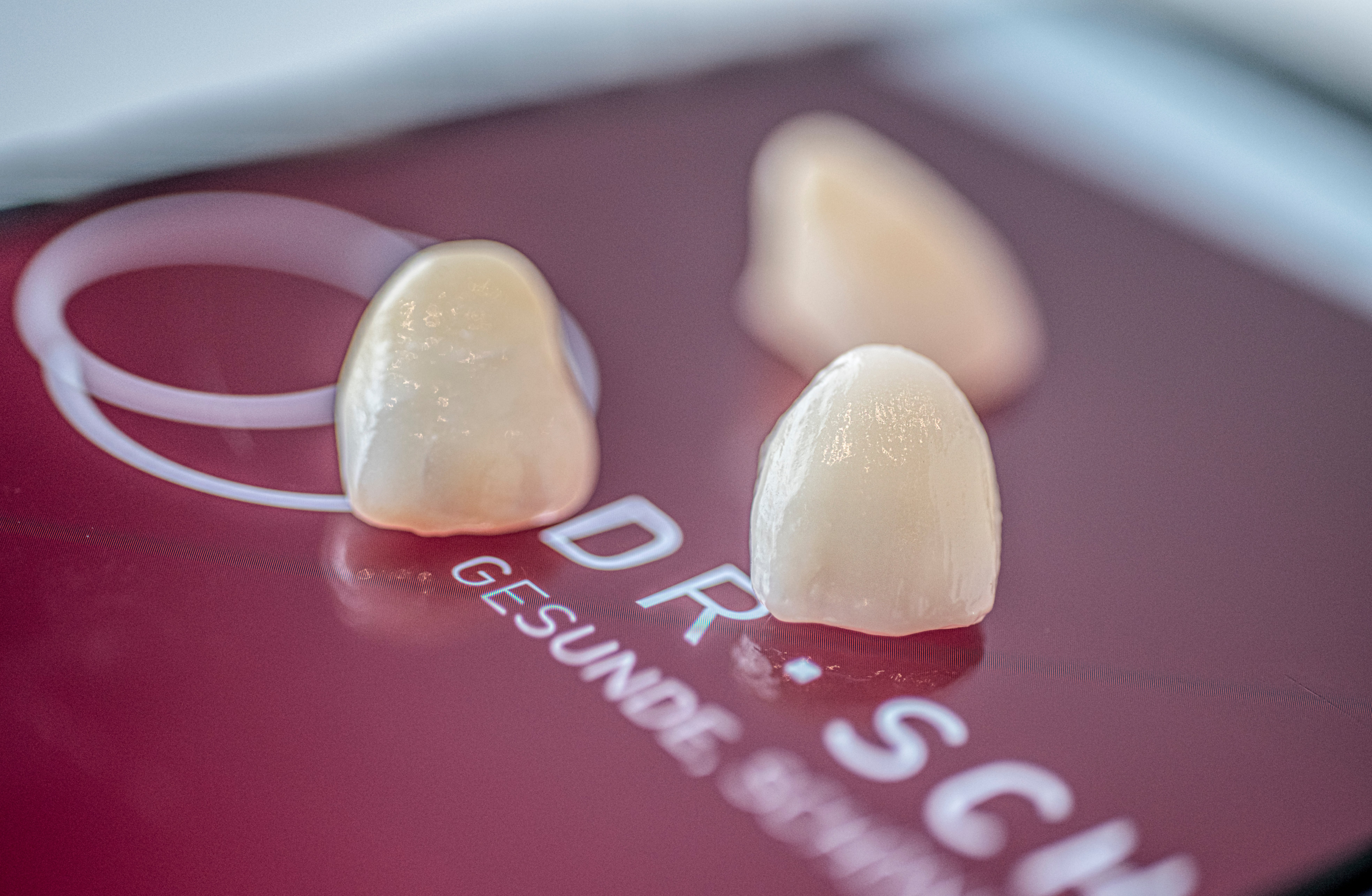 Veneers